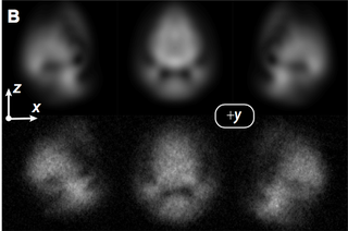 The shadow of the skyrmion, demonstrating the complex structure of the particles clumping in three different spin states. The top row shows what the team expected to see based on theory, and the bottom shows what they actually saw.